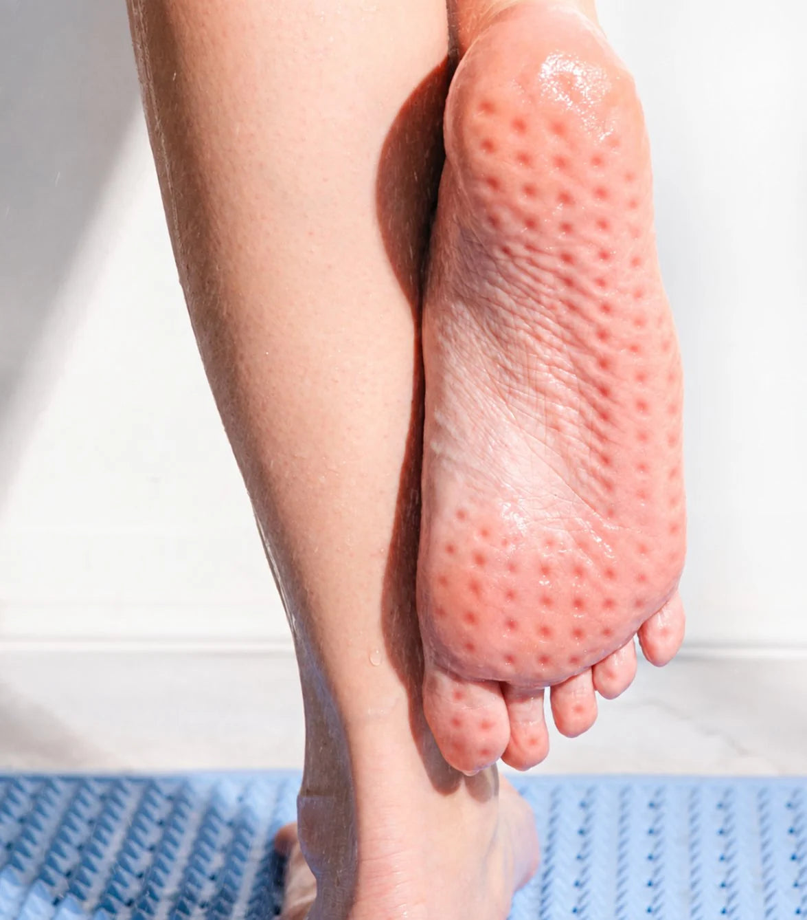The sole of a foot showing indents from the PVRA mat's spikes